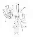 Fig. 10 - DEVICE AND METHOD FOR SALVAGING MYOCARDIUM FOLLOWING HEART ATTACK