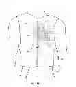 Fig. 11 - DEVICE AND METHOD FOR SALVAGING MYOCARDIUM FOLLOWING HEART ATTACK