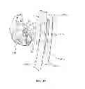 Fig. 12 - DEVICE AND METHOD FOR SALVAGING MYOCARDIUM FOLLOWING HEART ATTACK