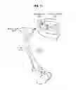 Fig. 20 - Exercise support apparatus and exercise support method