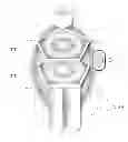 Fig. 01 - Circulatory flow restoration device