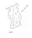 Fig. 14 - SYSTEMS AND METHODS OF COSMETO-COMPRESSION APPAREL