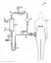 Fig. 01 - Glucose management and dialysis method and apparatus