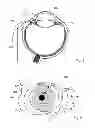 Fig. 02 - Device for adjusting the intraocular pressure