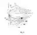 Fig. 03 - Device for adjusting the intraocular pressure