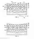 Fig. 03 - Re-epithelialization wound dressings and systems