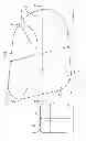 Fig. 01 - Parachute ostomy pouch