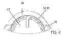 Fig. 07 - Catheter with depth electrode for dual-purpose use