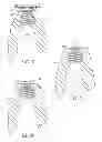 Fig. 07 - Device for creating temporary access and then closure