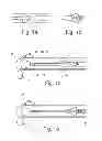 Fig. 02 - Catheter assembly
