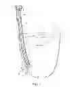 Fig. 08 - Catheter assembly