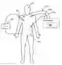 Fig. 01 - Radio Frequency Procedure Protection