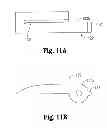 Fig. 07 - Surgical apparatus
