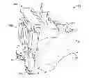Fig. 01 - Programmable femoral pin guide