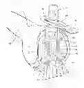 Fig. 01 - Femoral sizing guide