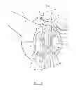 Fig. 07 - Femoral sizing guide