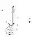 Fig. 08 - Pediatric internal mandibular distractor