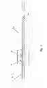 Fig. 05 - METHOD AND APPARATUS FOR DELIVERING CEMENT PASTE INTO A BONE CAVITY