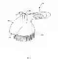 Fig. 04 - METHOD AND APPARATUS FOR POLISHING HUMAN SKIN