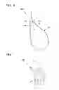 Fig. 09 - Tissue ligating device