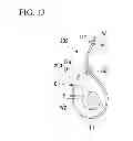 Fig. 11 - Tissue ligating device