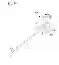 Fig. 12 - Tissue ligating device