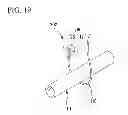 Fig. 15 - Tissue ligating device