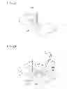Fig. 18 - Tissue ligating device