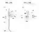 Fig. 22 - Tissue ligating device