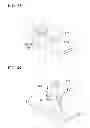 Fig. 30 - Tissue ligating device