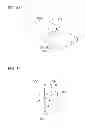 Fig. 31 - Tissue ligating device