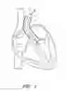 Fig. 02 - Suturing devices and methods for suturing an anatomic valve