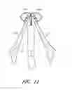 Fig. 14 - Suturing devices and methods for suturing an anatomic valve