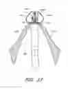 Fig. 16 - Suturing devices and methods for suturing an anatomic valve