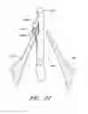Fig. 24 - Suturing devices and methods for suturing an anatomic valve