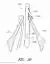 Fig. 29 - Suturing devices and methods for suturing an anatomic valve