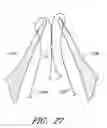 Fig. 30 - Suturing devices and methods for suturing an anatomic valve