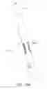 Fig. 43 - Suturing devices and methods for suturing an anatomic valve