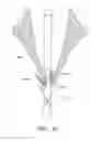 Fig. 46 - Suturing devices and methods for suturing an anatomic valve