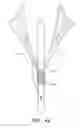 Fig. 49 - Suturing devices and methods for suturing an anatomic valve
