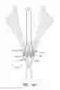 Fig. 53 - Suturing devices and methods for suturing an anatomic valve
