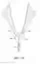 Fig. 58 - Suturing devices and methods for suturing an anatomic valve
