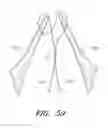 Fig. 60 - Suturing devices and methods for suturing an anatomic valve