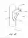 Fig. 63 - Suturing devices and methods for suturing an anatomic valve