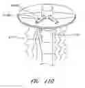 Fig. 86 - Suturing devices and methods for suturing an anatomic valve