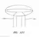 Fig. 89 - Suturing devices and methods for suturing an anatomic valve
