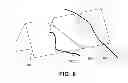 Fig. 09 - MINIMALLY INVASIVE SURGICAL KIT