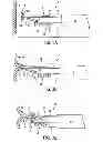 Fig. 03 - APPARATUS AND METHODS FOR FORMING AND SECURING GASTROINTESTINAL TISSUE FOLDS