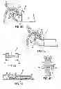 Fig. 04 - APPARATUS AND METHODS FOR FORMING AND SECURING GASTROINTESTINAL TISSUE FOLDS