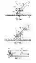 Fig. 12 - APPARATUS AND METHODS FOR FORMING AND SECURING GASTROINTESTINAL TISSUE FOLDS